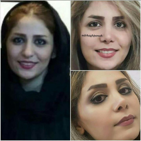 هزینه عمل دکتر حق پناه شیراز